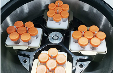 Comment choisir le tube de centrifugeuse