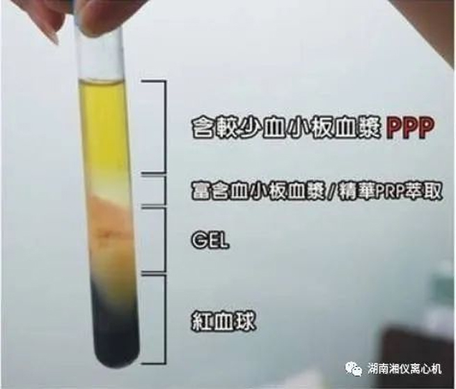 【Science Popularisation 】 PRP Sérum Autologue Beauté