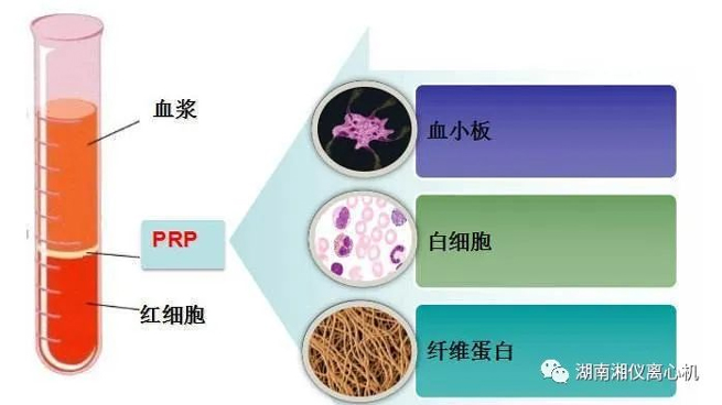 【Science Popularisation 】 PRP Sérum Autologue Beauté